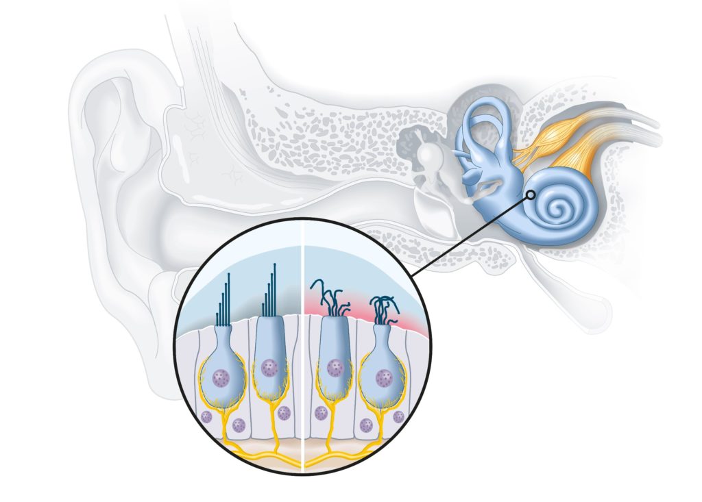 Une thérapie génique pour régénérer les cellules sensorielles de l’oreille