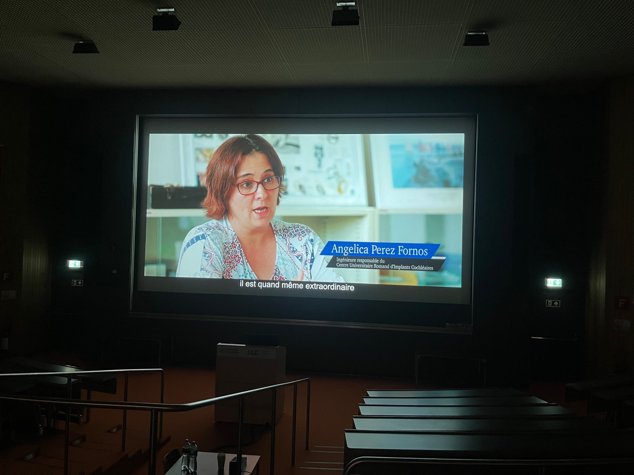 Le film « L’aventure de l’implant cochléaire en Suisse romande » projeté aux HUG